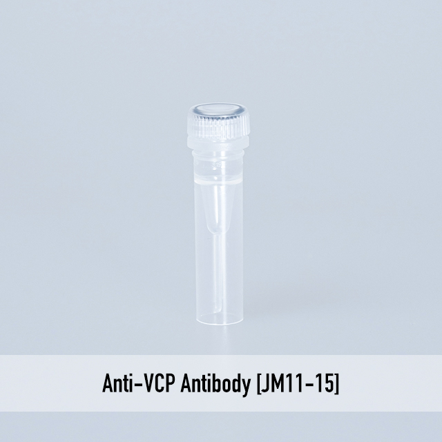 Anti-VCP Antibody [JM11-15]