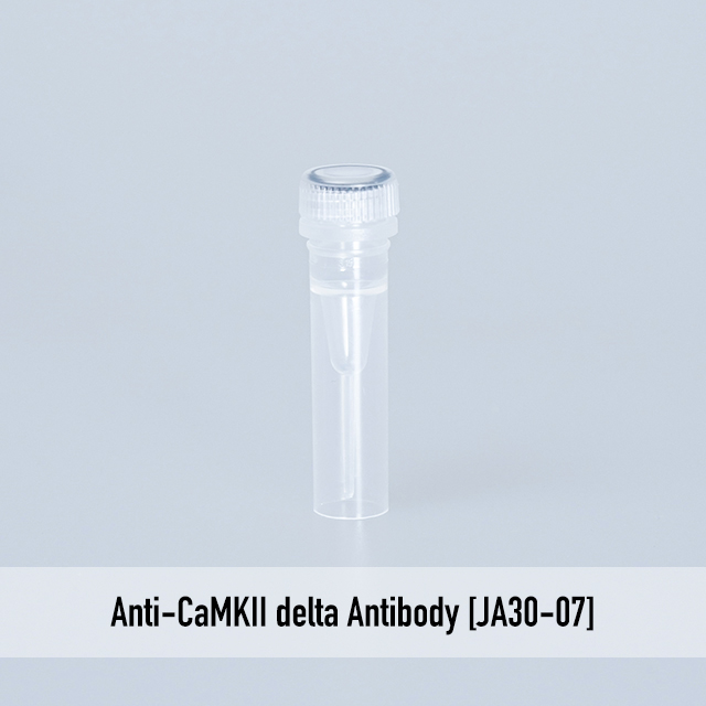 Anti-CaMKII delta Antibody [JA30-07]